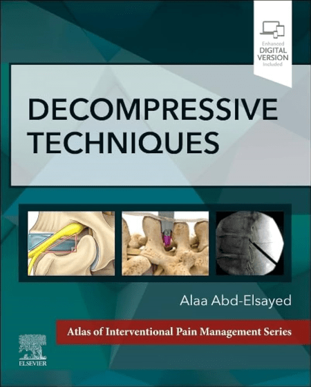 Decompressive Techniques (Atlas of Interventional Pain Management) 1st Edition
