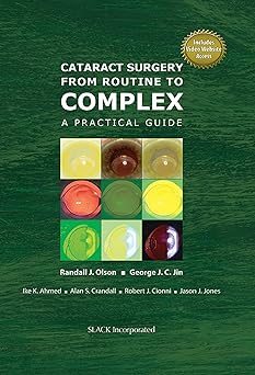 Cataract Surgery From Routine To Complex: A Practical Guide