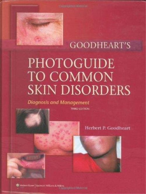 Goodheart’s Photoguide To Common Skin Disorders: Diagnosis And Management