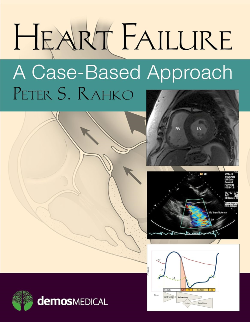 Heart Failure: A Case Based Approach